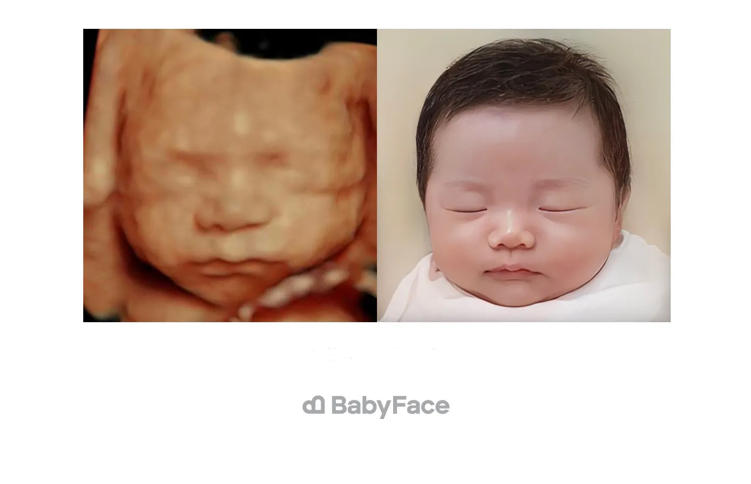 어제 베이비페이스 받았어요!