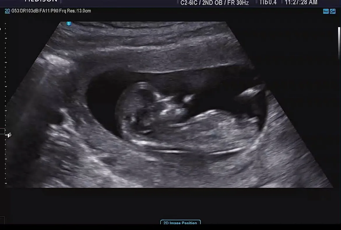 community post image