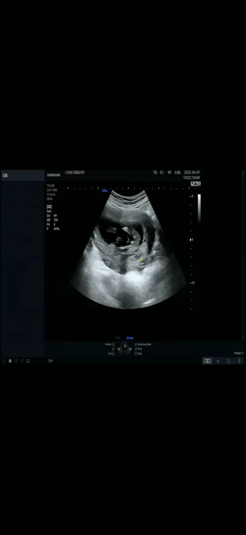 16주 성별 9:1!!