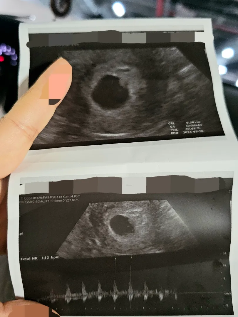 생예로 5주5일 심소듣고왔어요!