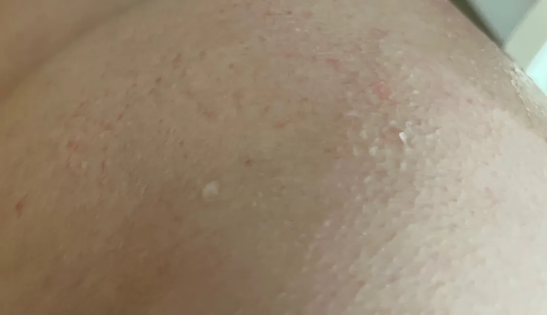 이거 튼건가요?