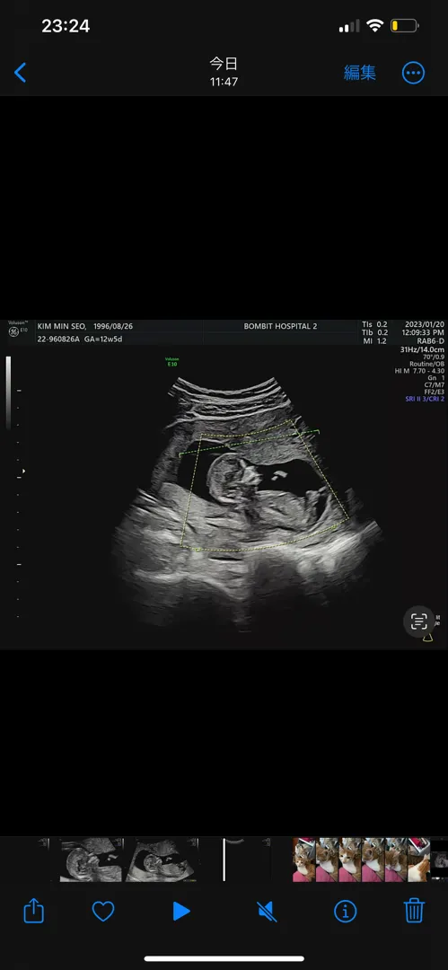 12주 5일 초음파 참견부탁드립니다!