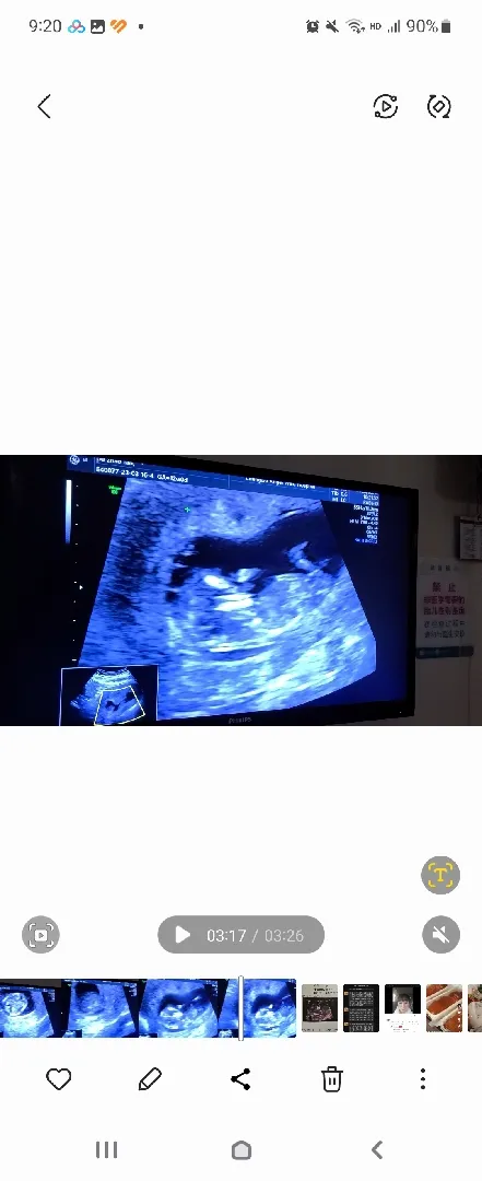 성별 너무 궁금하네요 ㅠㅠ