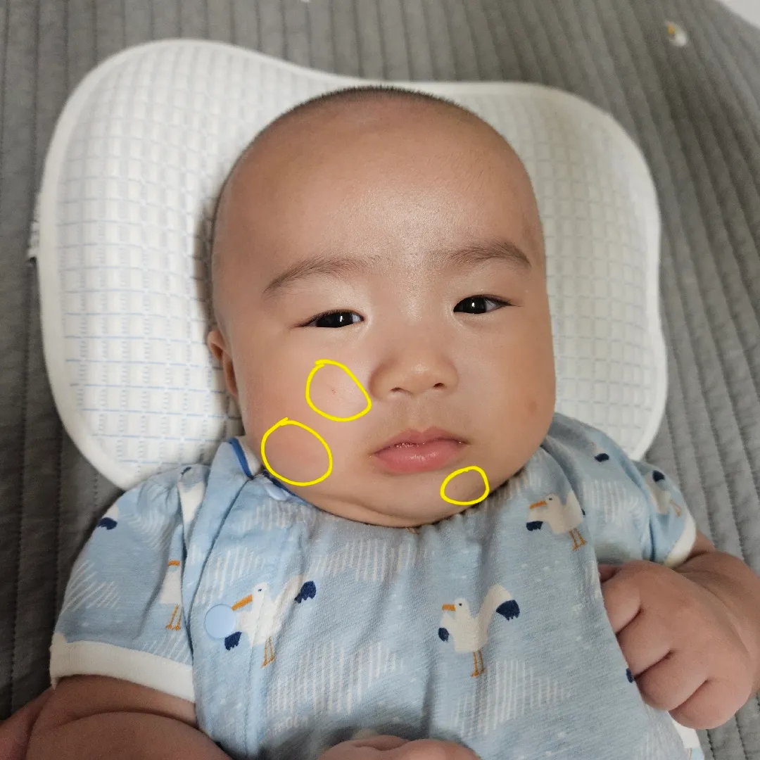 얼굴을 쥐어뜯고 난리도 아니네여...