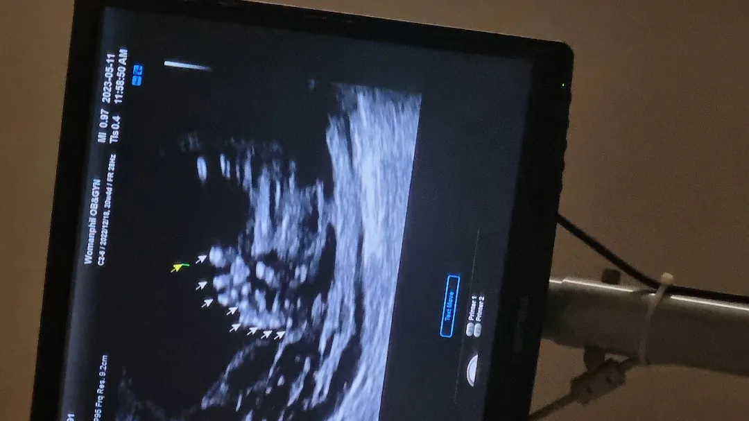  저하루종일 울엇어요 ㅠㅠ 