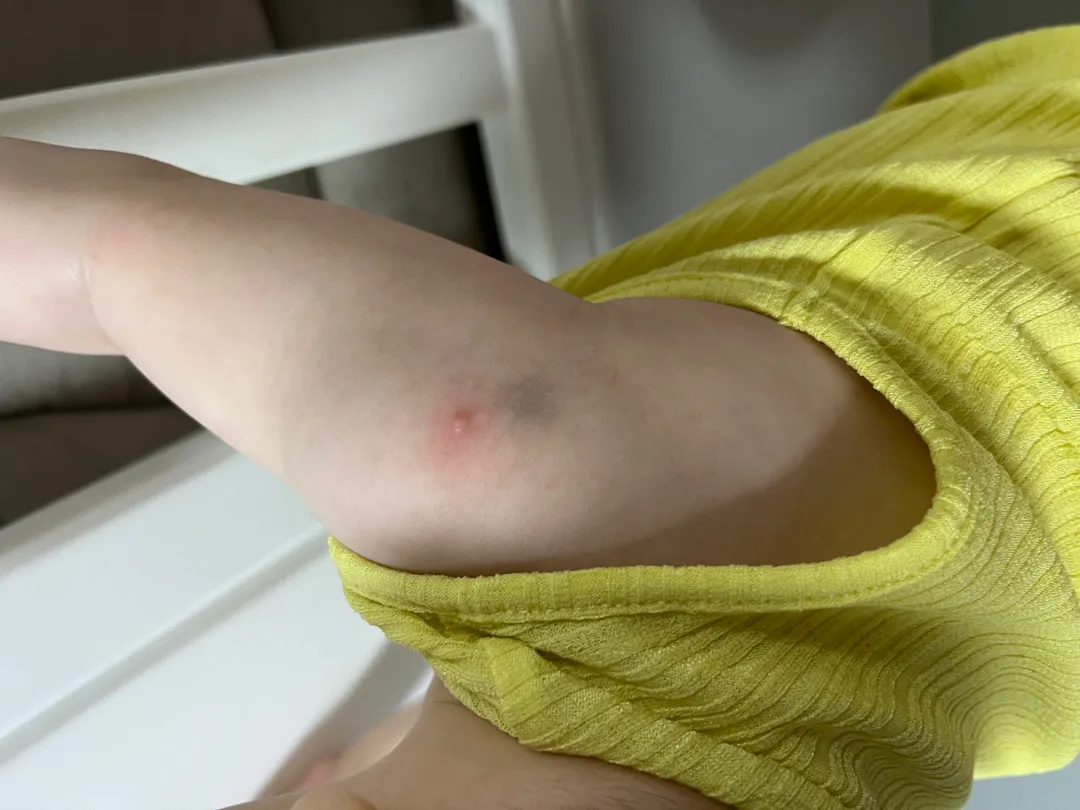 이게 뭘까요ㅠㅠㅠ