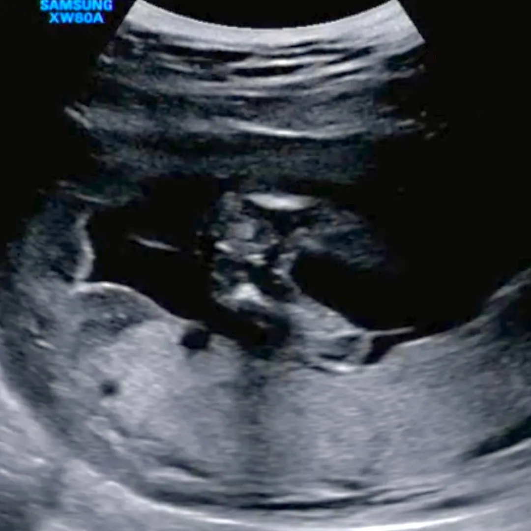 16주1일차 성별 확인하고 왔어요:)