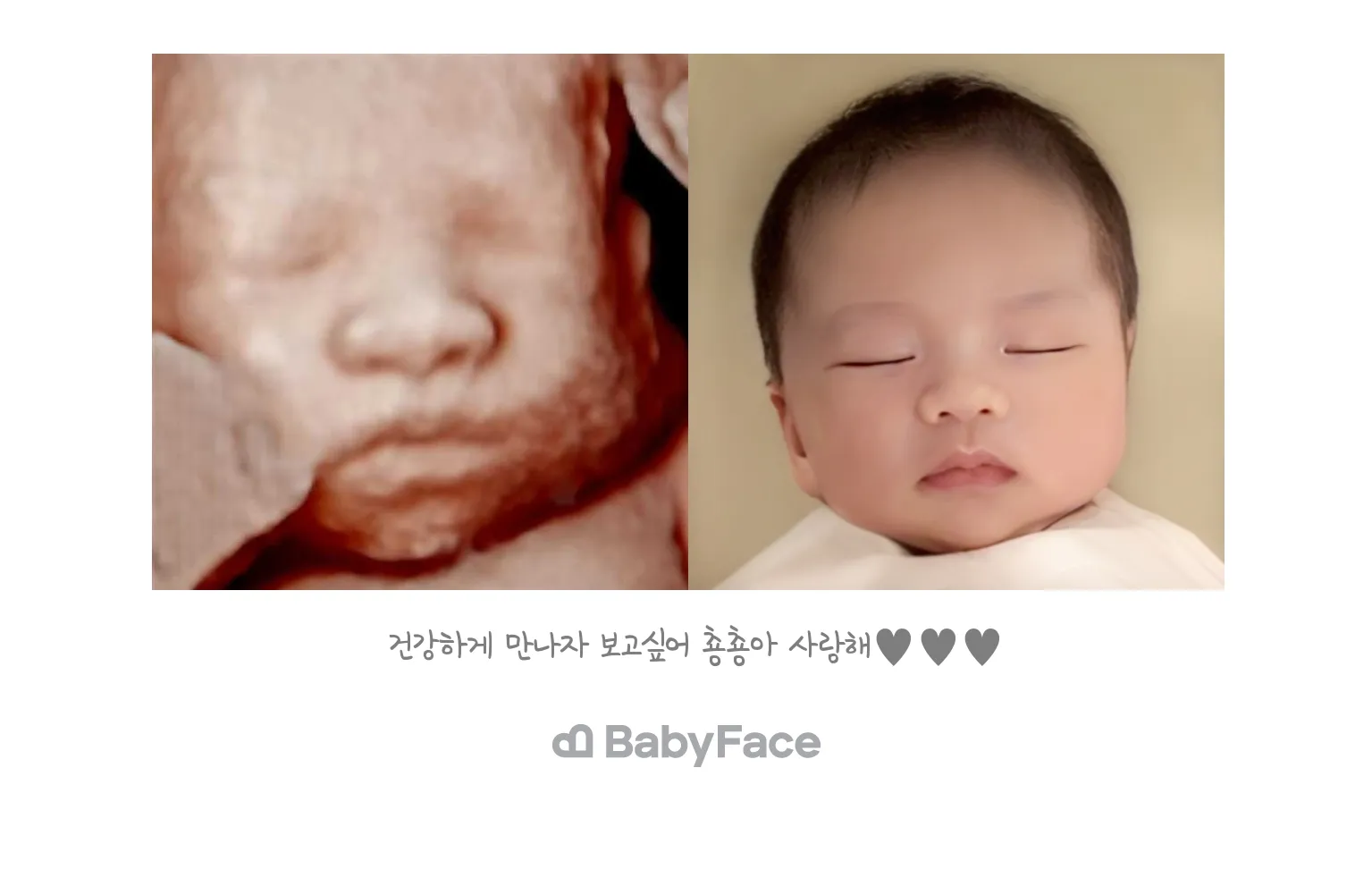 [자랑글]드뎌 춍춍이 입체초음파를 했습니다!!