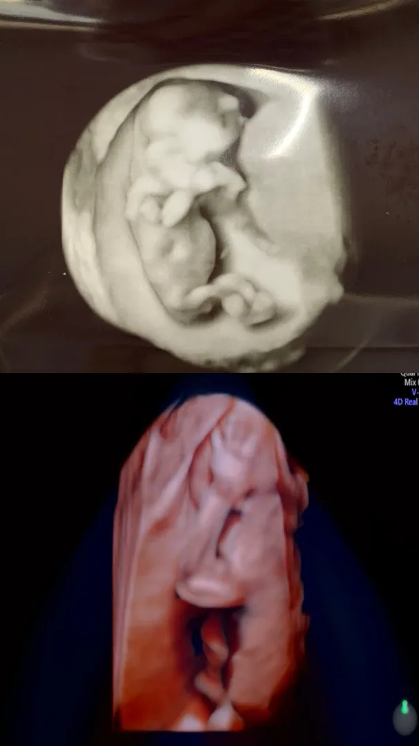 21주차 1일! 2차 정밀초음파 보고왔어요👶