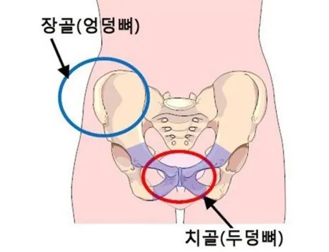 아래 뼈(치골)아프신분 계세요?ㅠㅠ