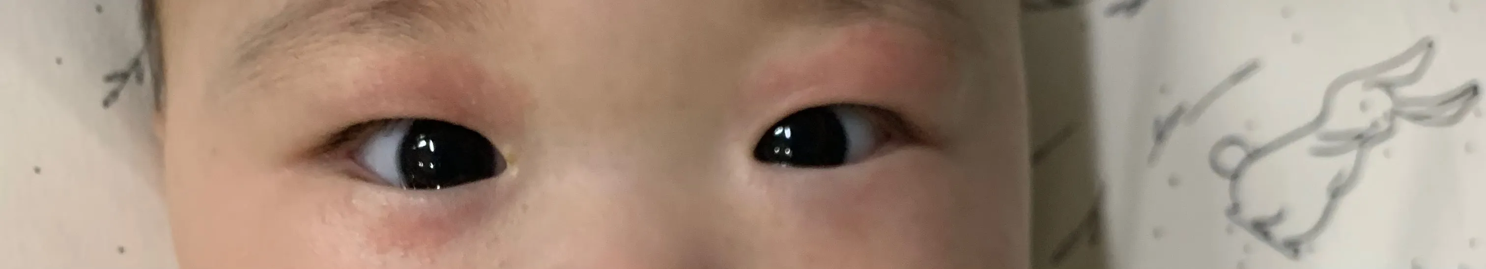 눈 비비는 아이