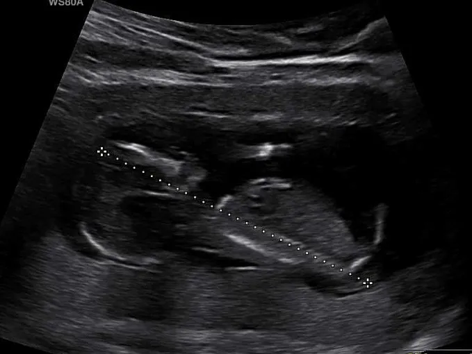 각도법 부탁드립니다👶🏻🫶🏻