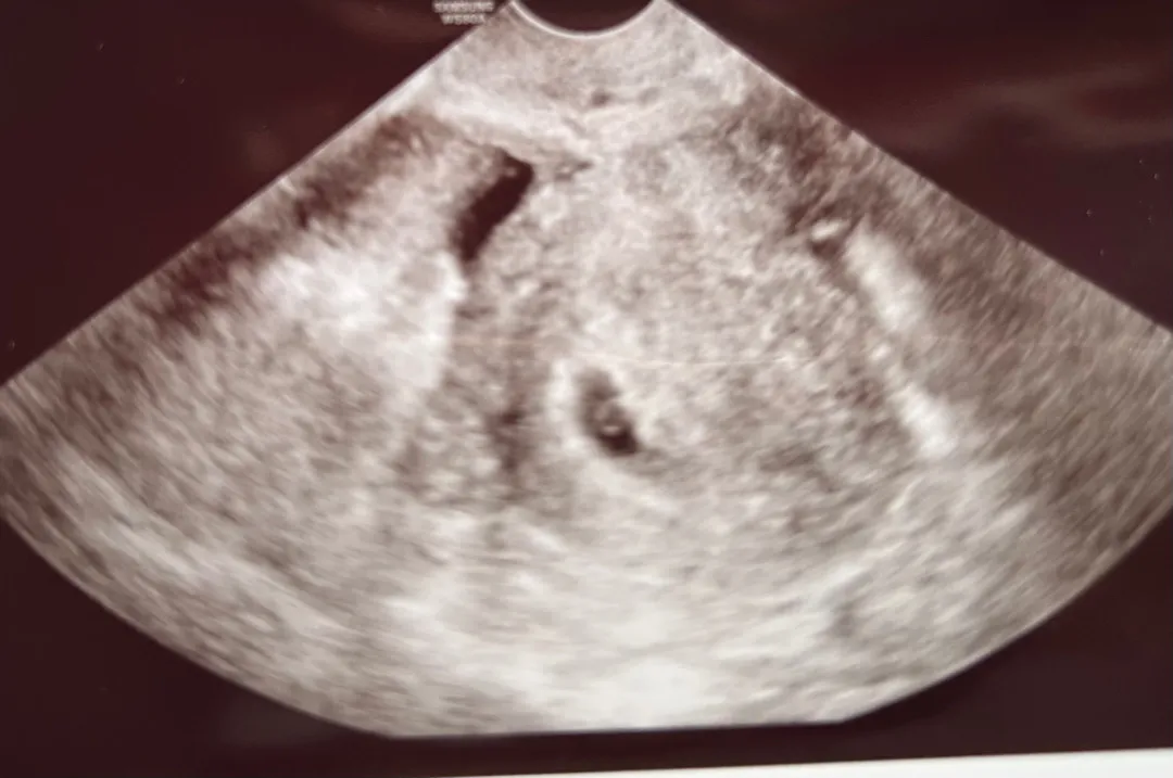 community post image
