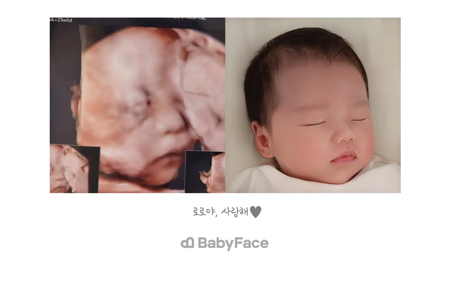 베이비페이스 했어요!