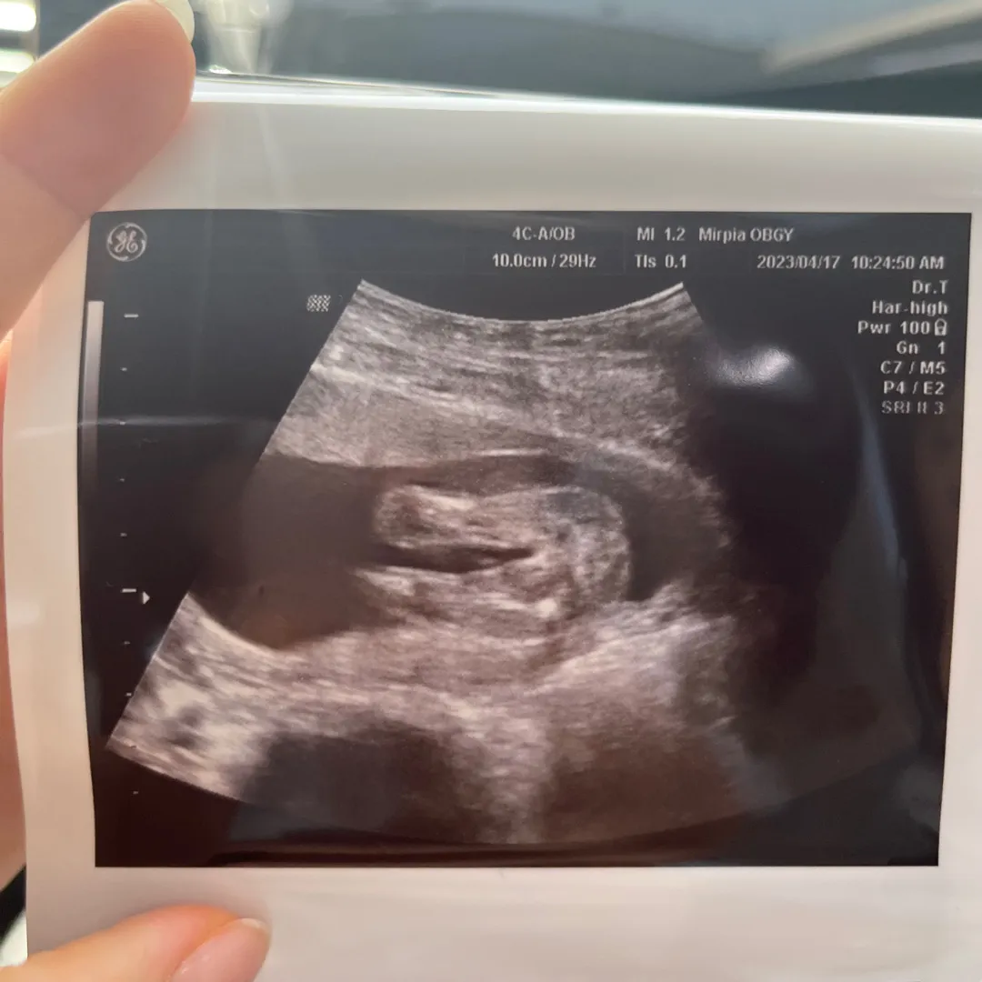 16주6일 촘파 성별,,!!