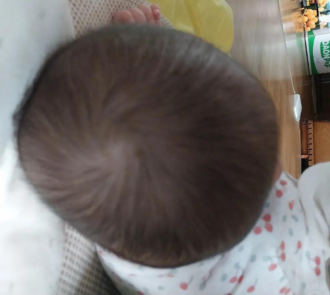 소은이 두상이 못생겼어요ㅠㅠ
