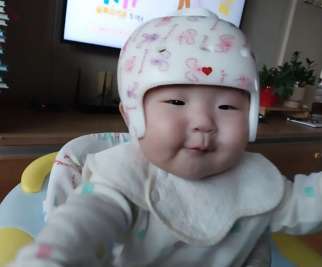 소은이 오늘부터 두상교정헬멧 착용했어요~