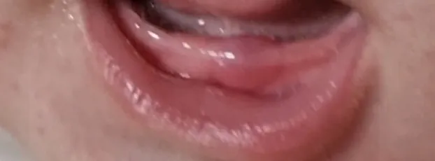 아이 잇몸이 왜이럴까요ㅜㅜ