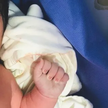 제왕절개로 출산했어요!👶🏻