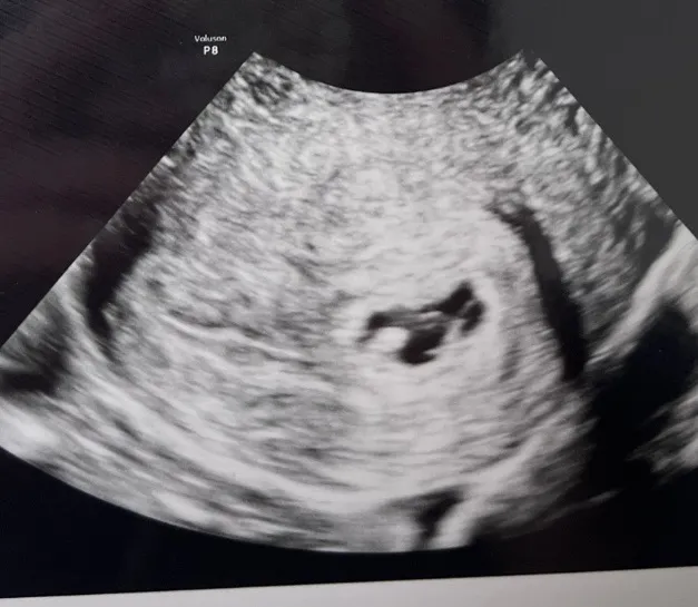 community post image