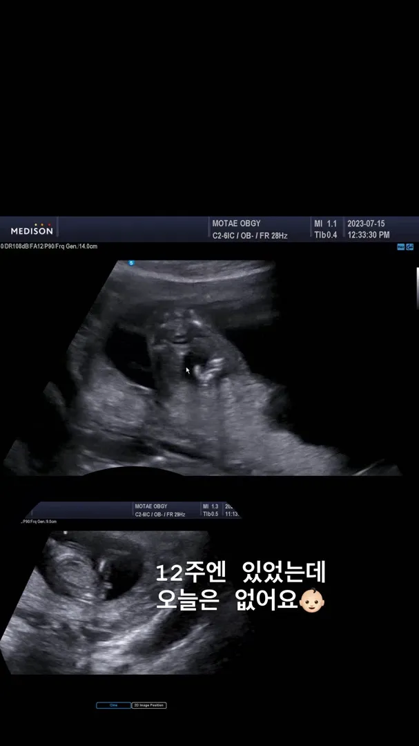 자매맘 되었어요🩷