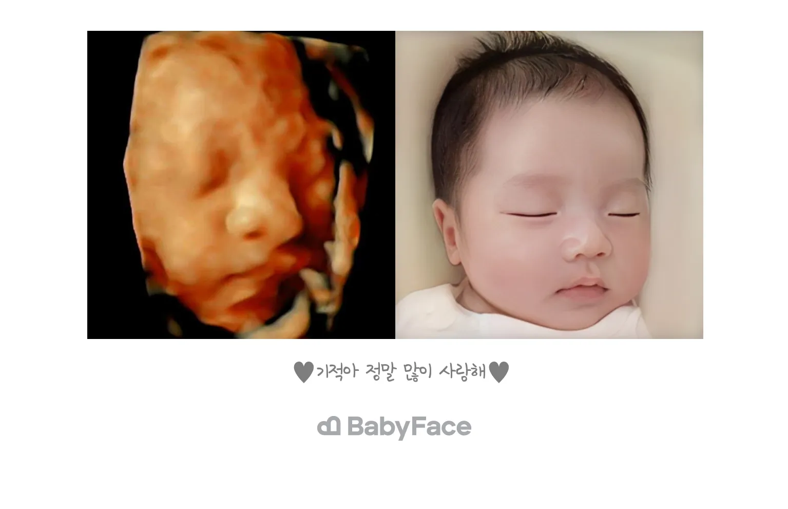 베이비 페이스 어제 신청하고 오늘 받았어요!