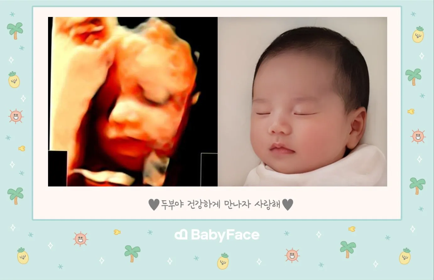 우리 아기도 베이비페이스 !! 