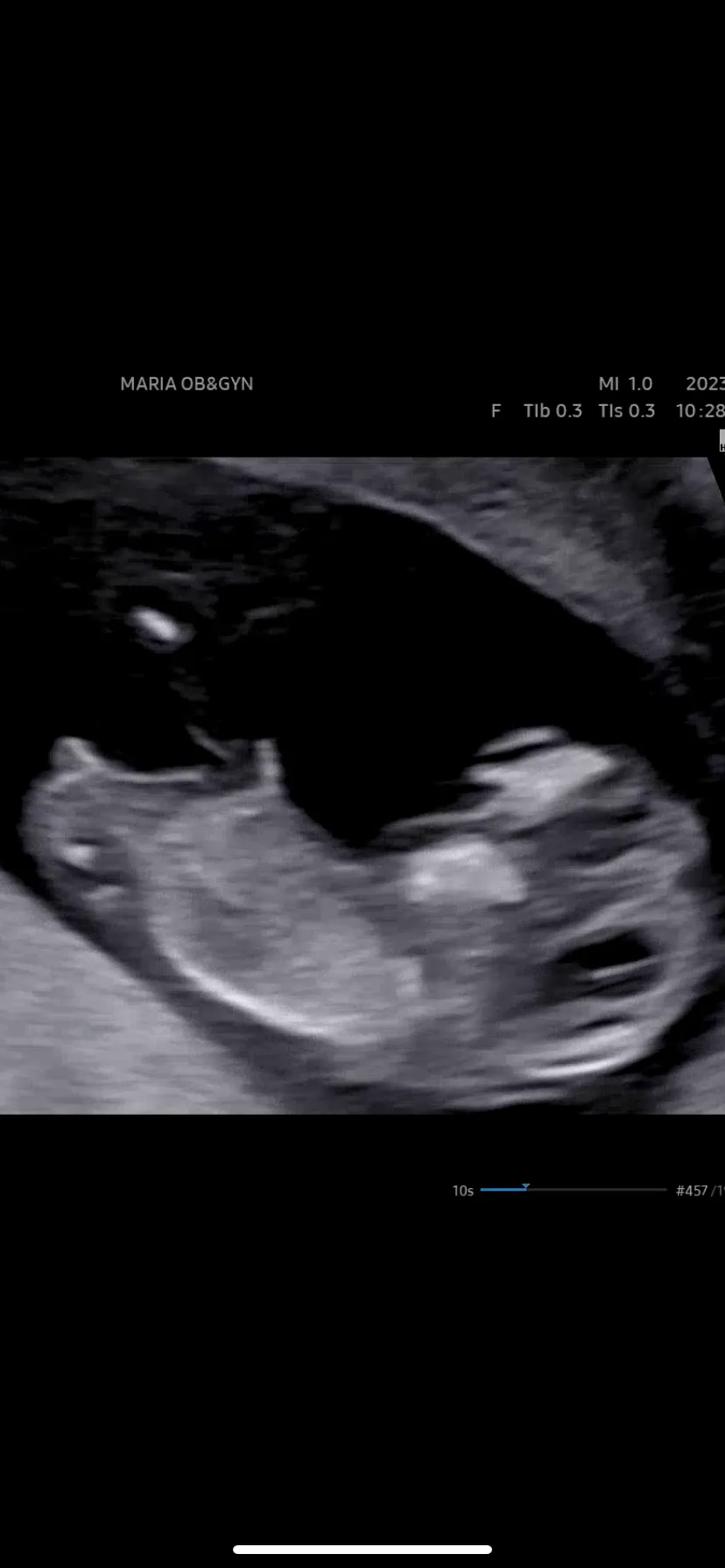 저도 성별 한번 봐주시면 감사하겠습니다 :)