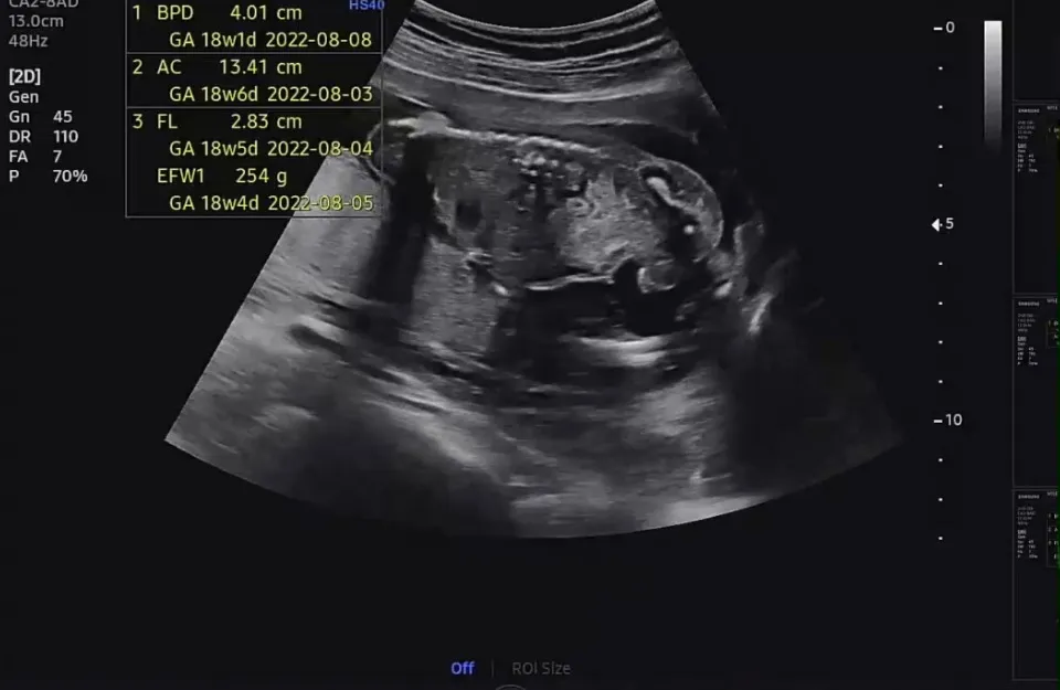 남자 아이맞죠? ㅎㅎ