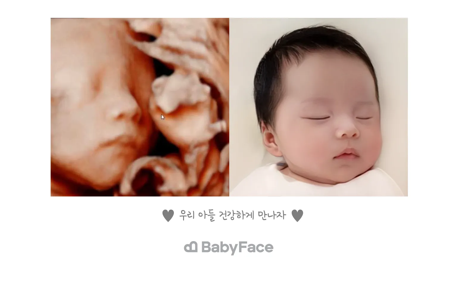 베이비페이스 👼🏻🤍