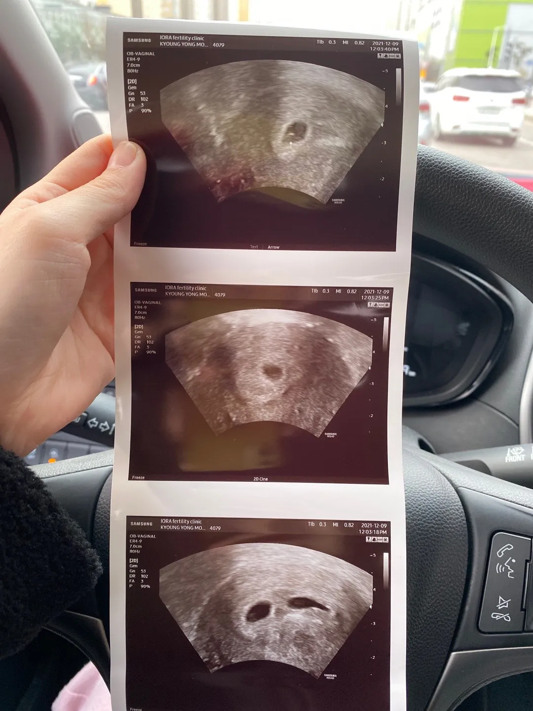 오늘 세쌍둥이 심장 소리 들을수 있겠죠?