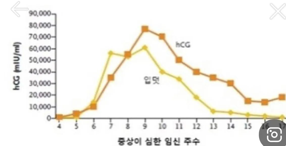 입덧 그래프