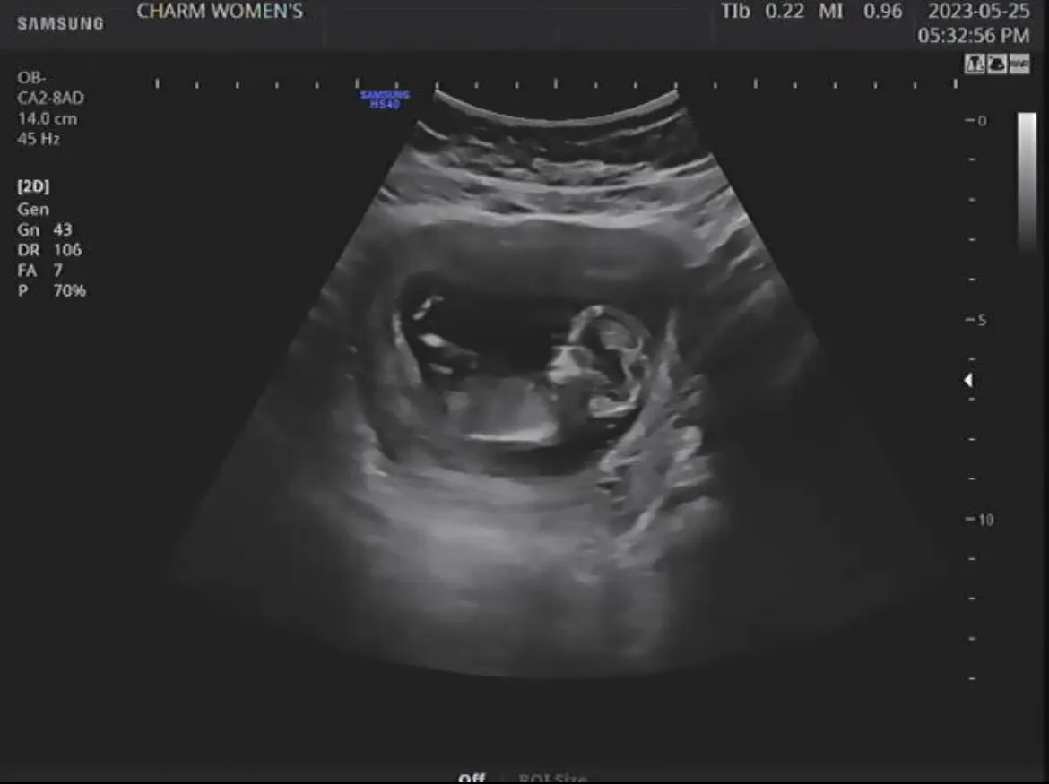 12주 각도법 부탁 드려도 될까요🥺