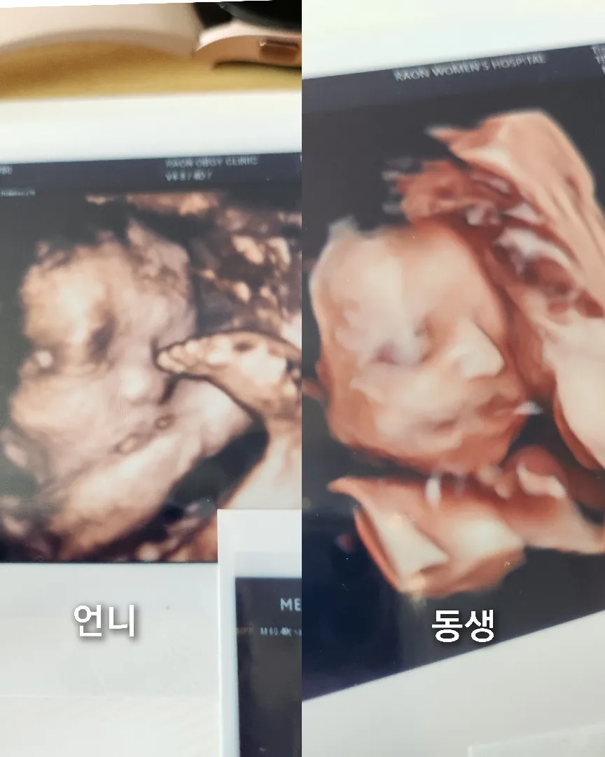 이제 두 번 남았따...🫠