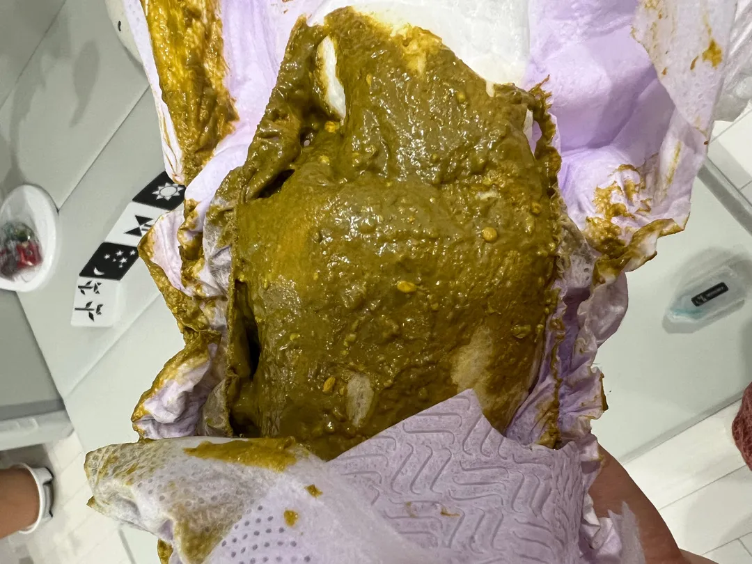 대변 색 좀 봐주세요
