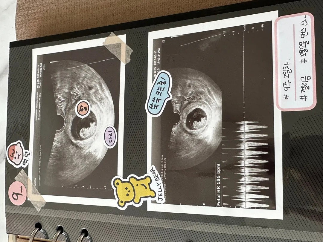 젤리곰 보구 왔어용☺️
