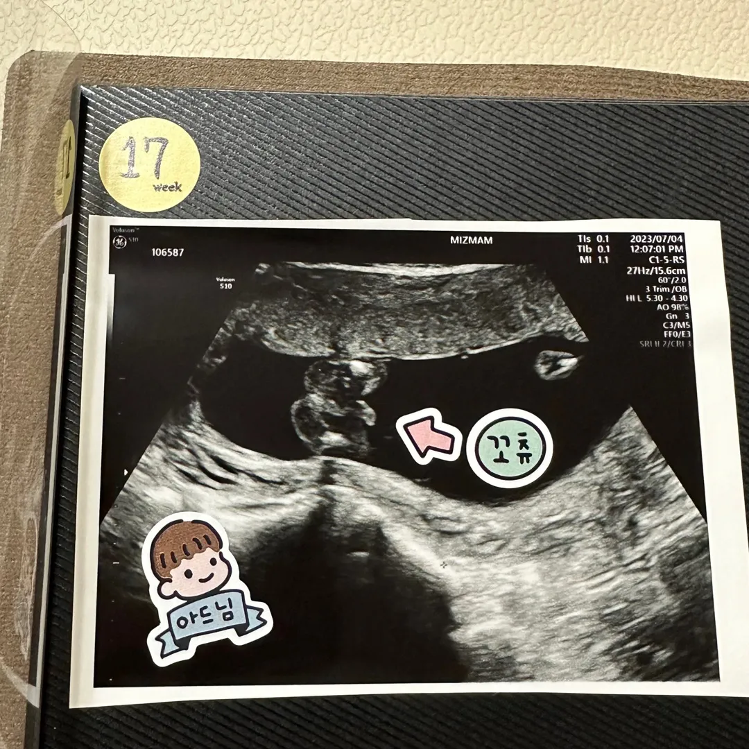 아들맘 확정 :) 엉덩이 포동포동 넘 귀엽네요