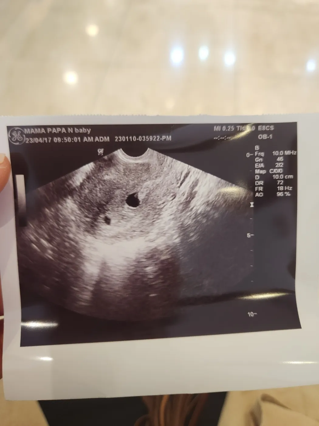 6주2일차 유산기높다는데 좀봐주세요(촘파)