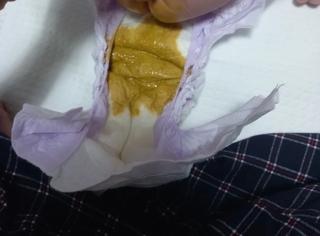 아기 변