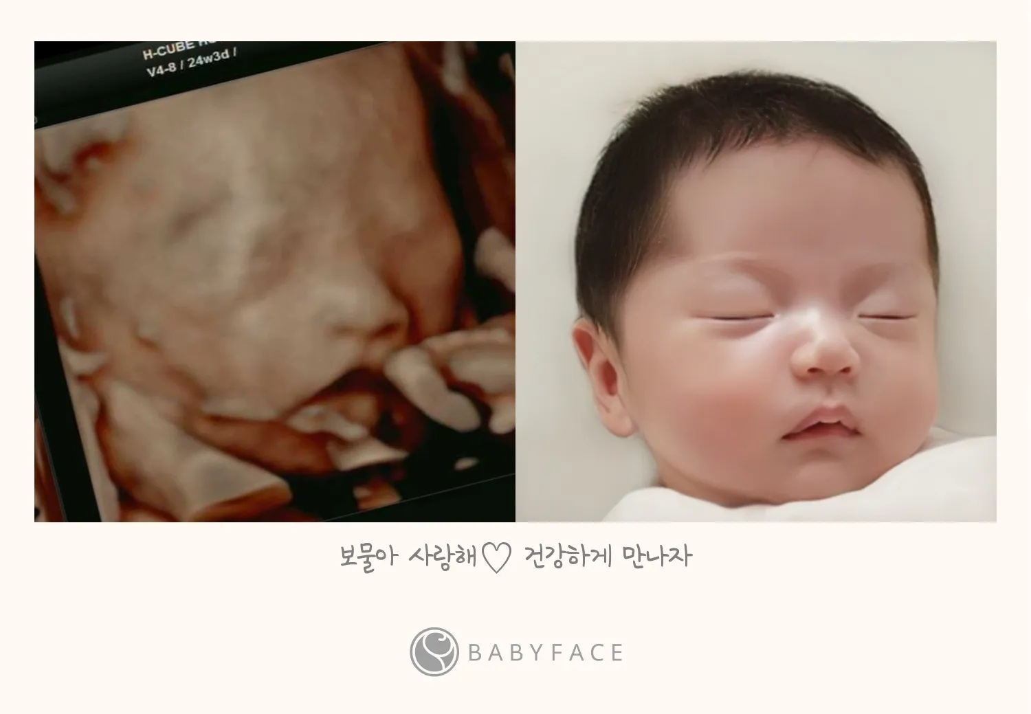 저도 했어요! 베이비페이스 👶🏻💓