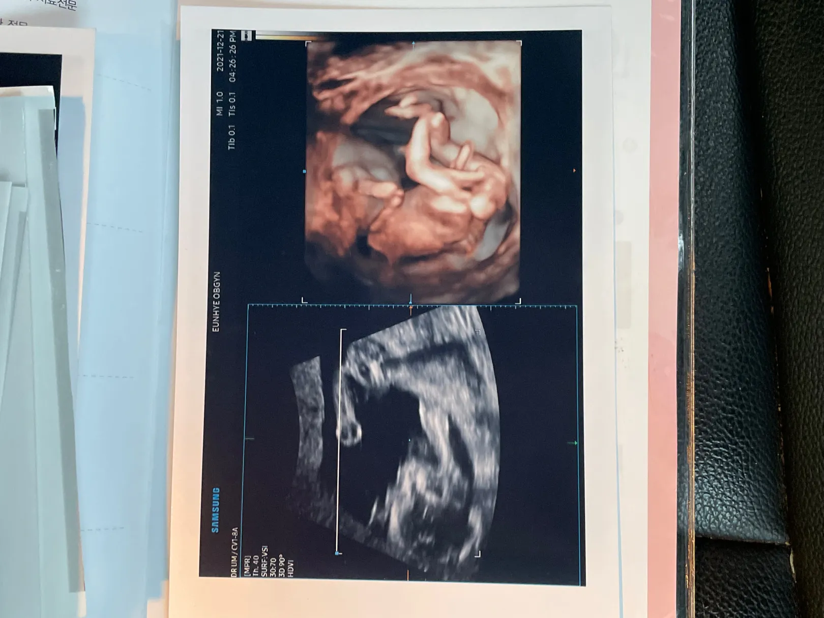 15주 6일, 성별 알려주셨는데요!(성별반전)