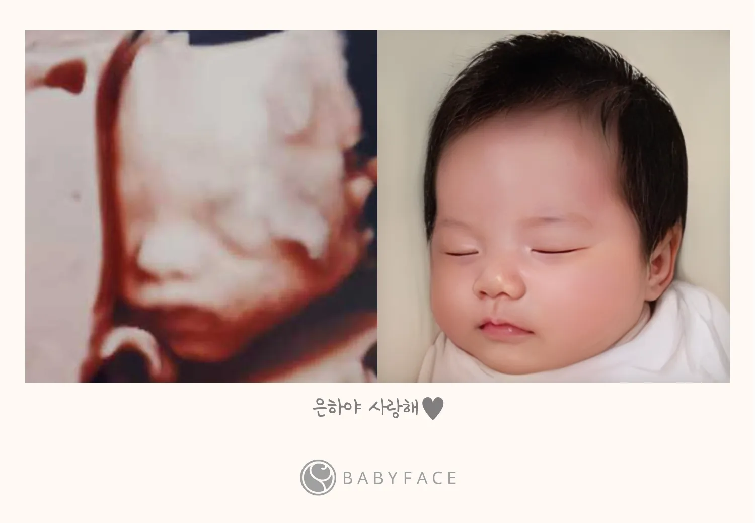 베이비 페이스 신청했어요!