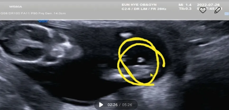 community post image