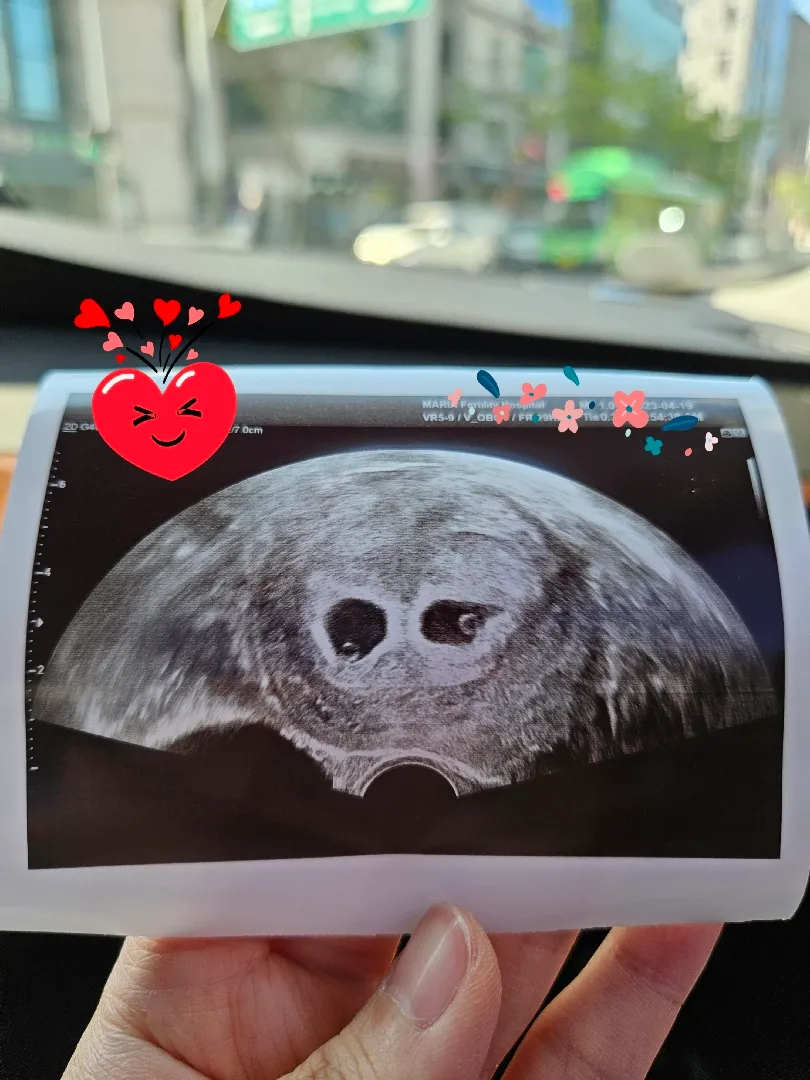 쌍둥이입니다^^