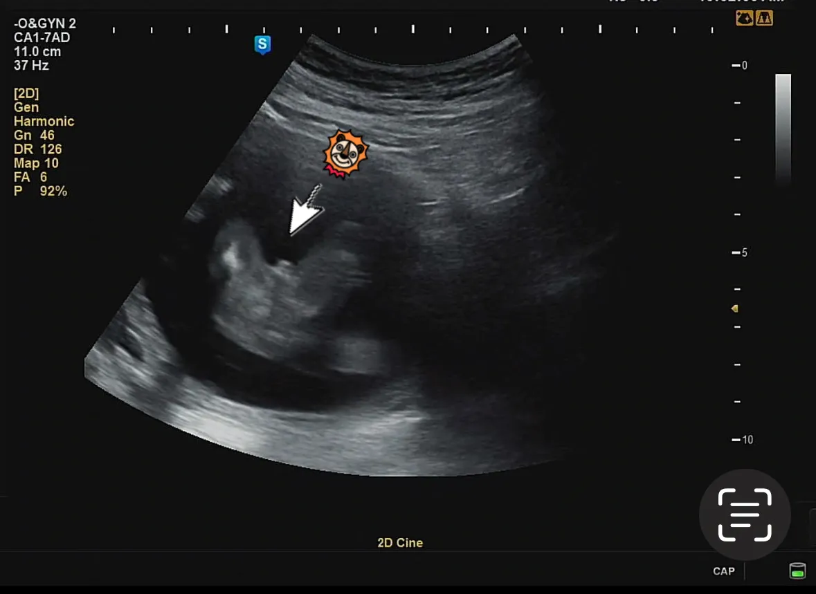 🌶️아들맘이 되었어요🌶️