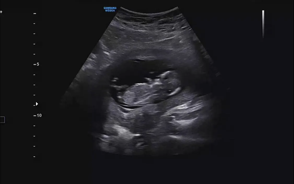 13주 1일 각도법~ 좀 알려주세용 ㅠ