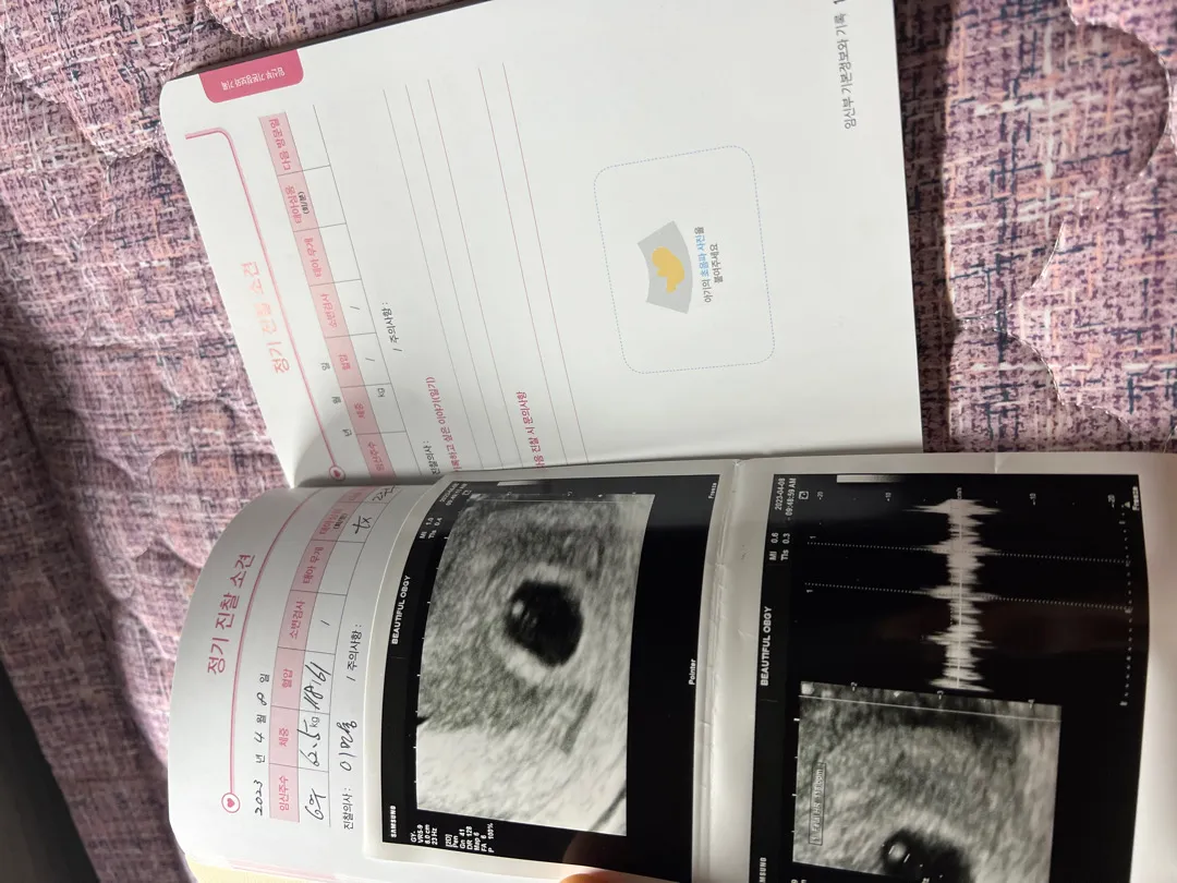 초록이# 아기집이랑 심장소리 듣고 왓어요❤️