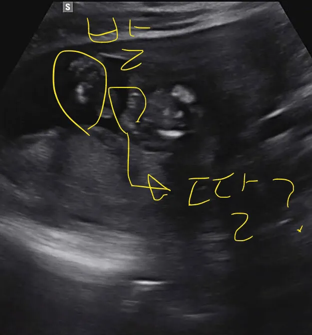 딸이 맞는건가요...?? 