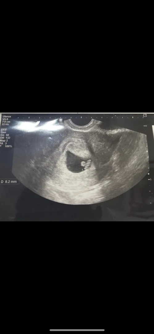 7주 6일째~ 