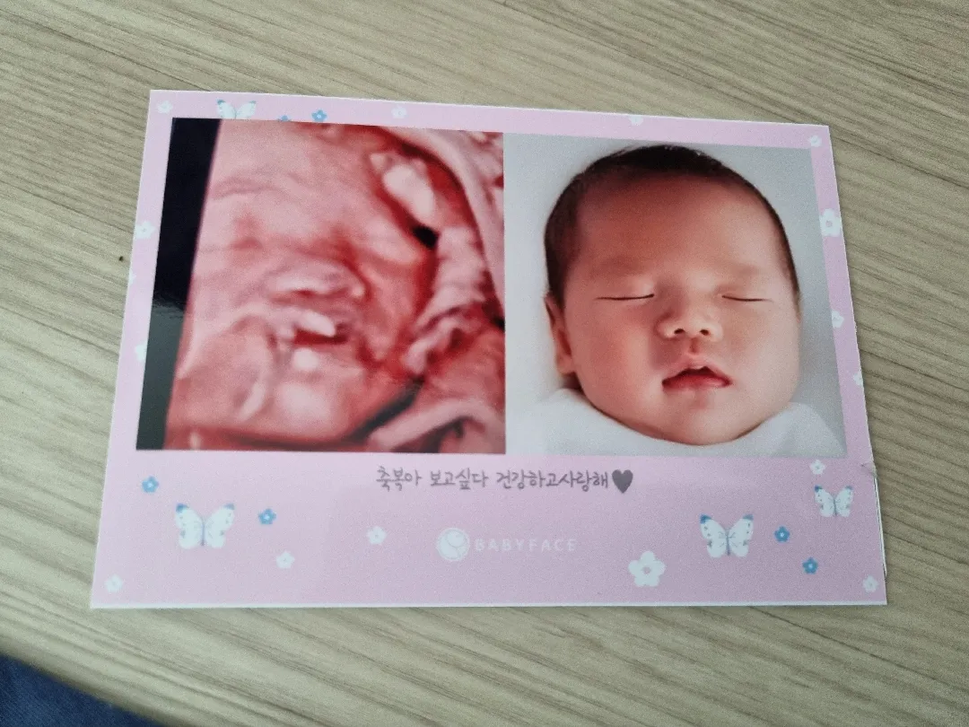 베이비 페이스 저희도 했어요